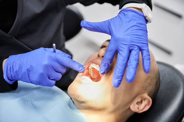 Best Broken or Chipped Tooth Repair in Cahokia, IL